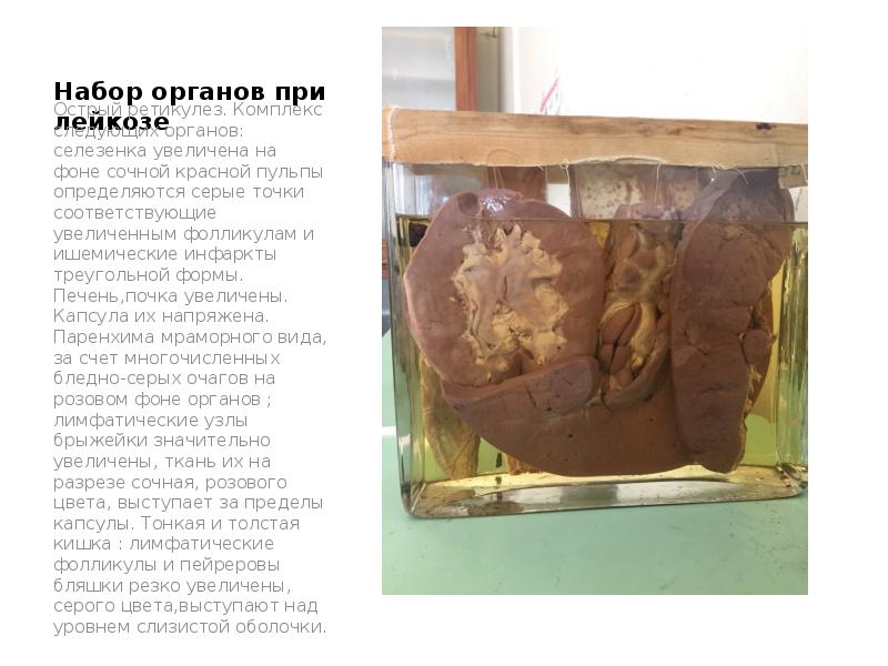 Набор органов при лейкозе
Острый ретикулез. Комплекс следующих органов: селезенка увеличена Набор органов при лейкозе
Острый ретикулез. Комплекс следующих органов: селезенка увеличена