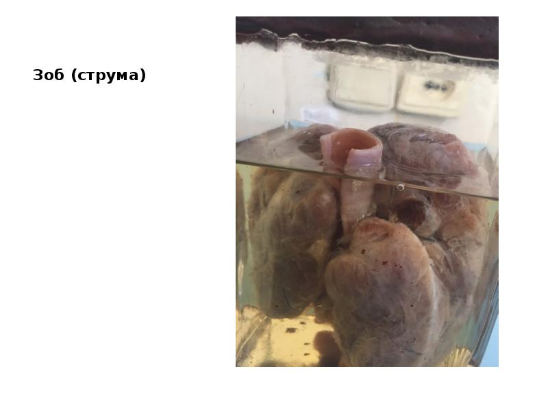 Зоб (струма)