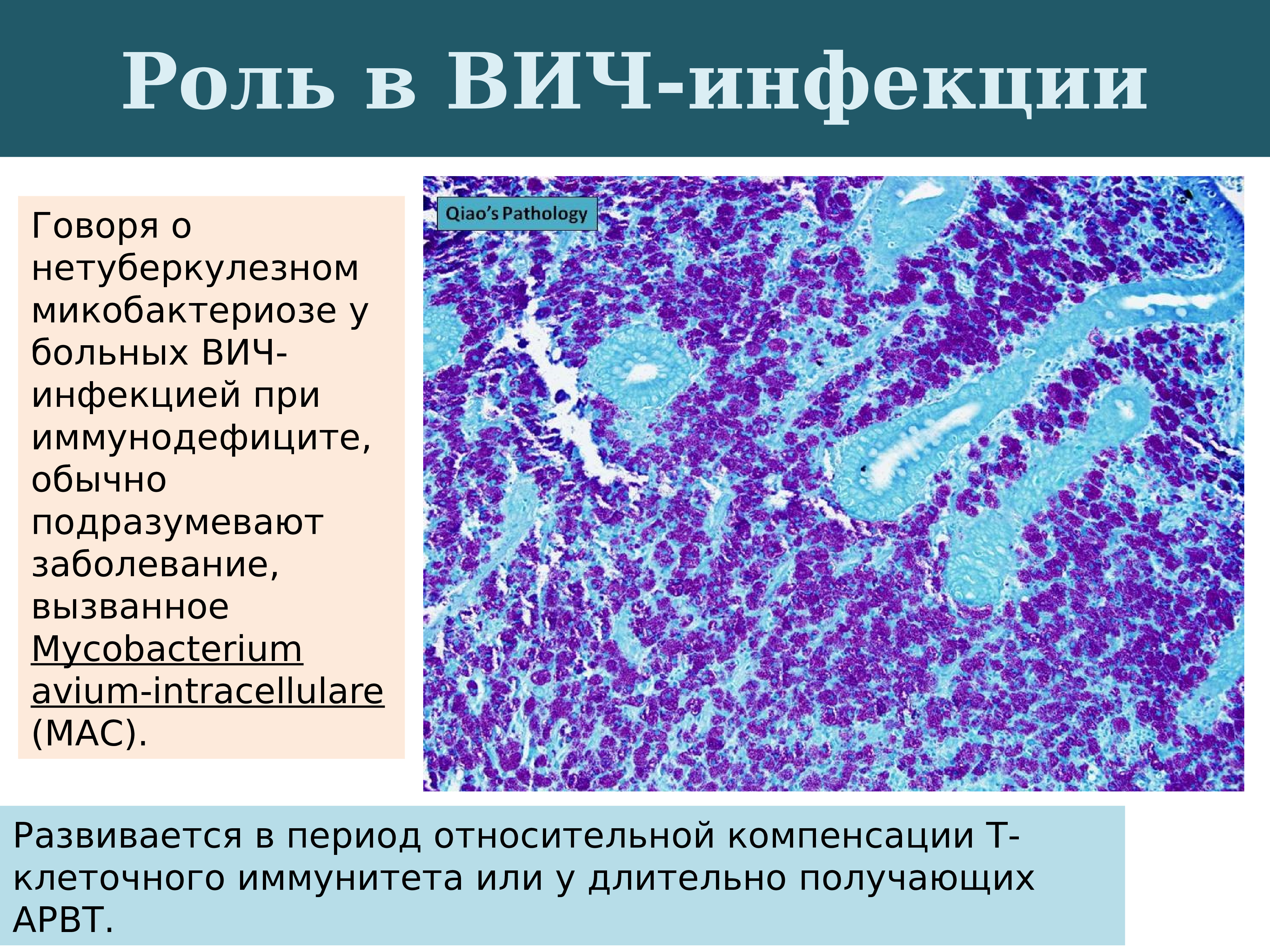 Нетуберкулезный микобактериоз гистология