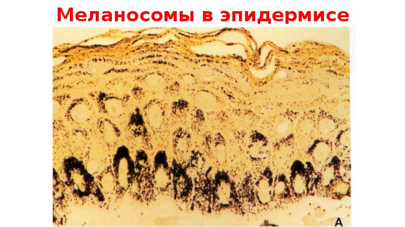 Меланосомы в эпидермисе Меланосомы в эпидермисе