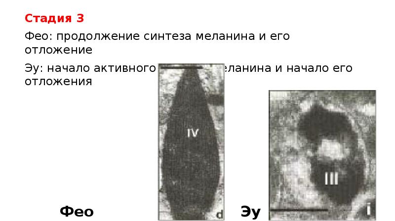 Стадия 3
Стадия 3
Фео: продолжение синтеза меланина и его отложение
Стадия 3
Стадия 3
Фео: продолжение синтеза меланина и его отложение