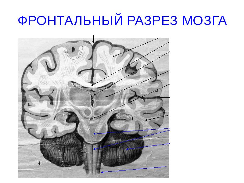 ФРОНТАЛЬНЫЙ РАЗРЕЗ МОЗГА