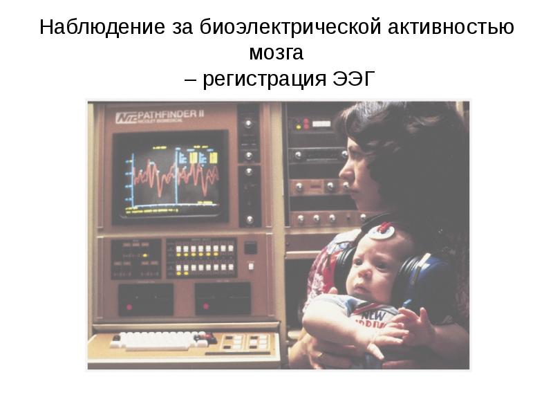 Наблюдение за биоэлектрической активностью мозга  – регистрация ЭЭГ