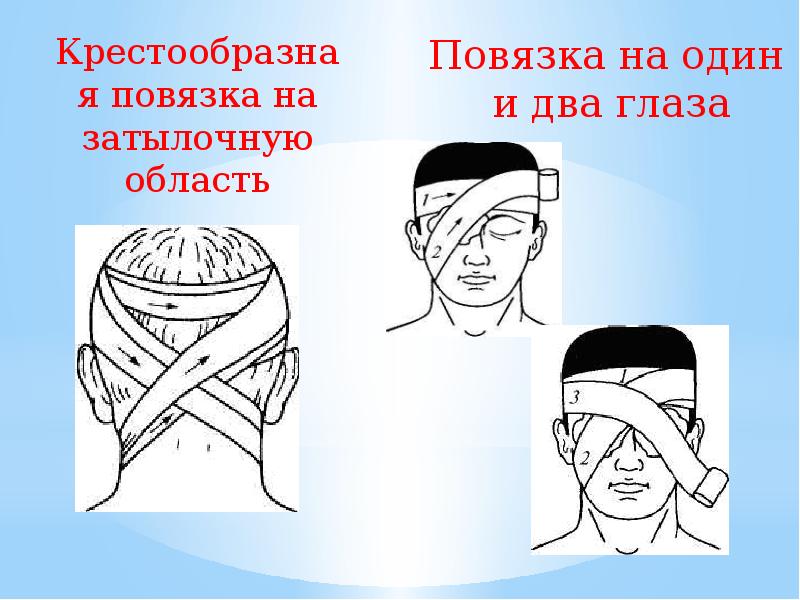 Десмургия презентация қазақша