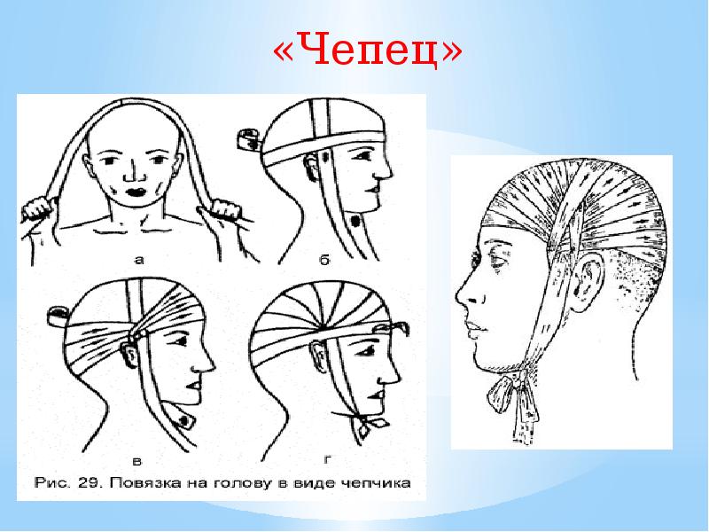 Проект по технологии повязка на голову 6 класс