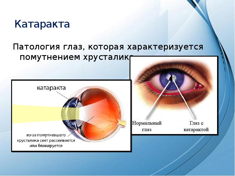 Заболевания и повреждения глаз презентация 8 класс