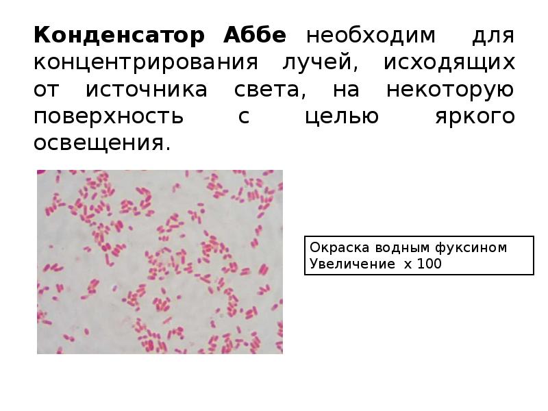 Конденсатор Аббе необходим для концентрирования лучей, исходящих от источника света, на