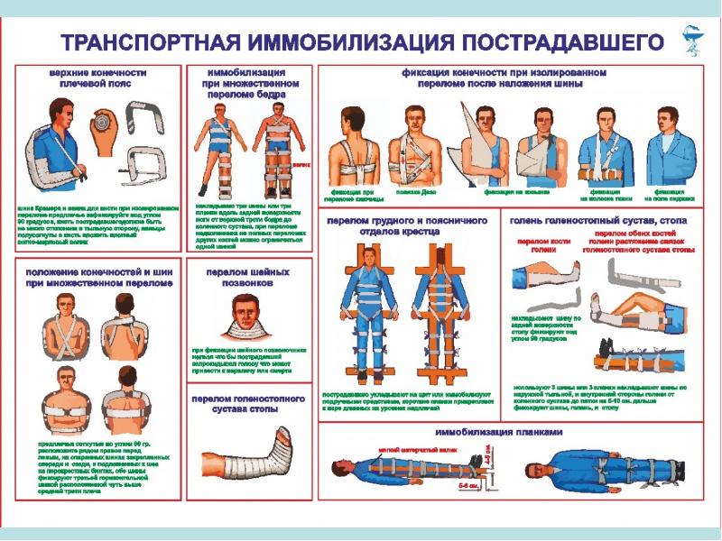 Лечебная иммобилизация презентация