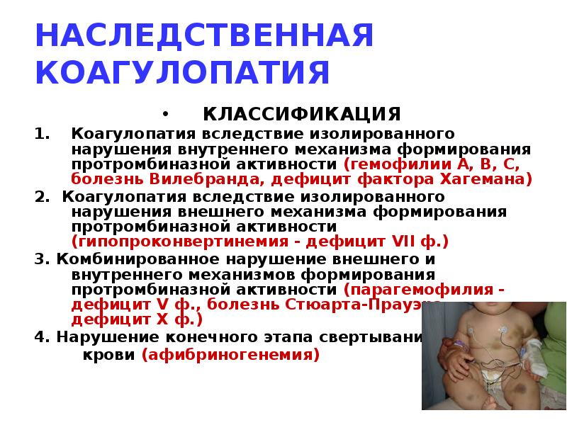 НАСЛЕДСТВЕННАЯ КОАГУЛОПАТИЯ
КЛАССИФИКАЦИЯ
Коагулопатия вследствие изолированного нарушения внутреннего механизма формирования протромбиназной НАСЛЕДСТВЕННАЯ КОАГУЛОПАТИЯ
КЛАССИФИКАЦИЯ
Коагулопатия вследствие изолированного нарушения внутреннего механизма формирования протромбиназной