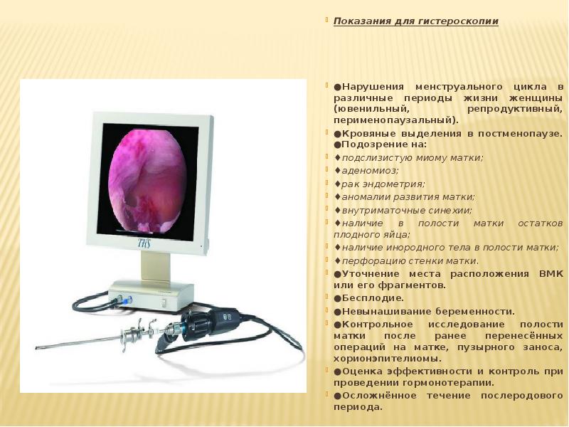 Офисная гистероскопия отзывы