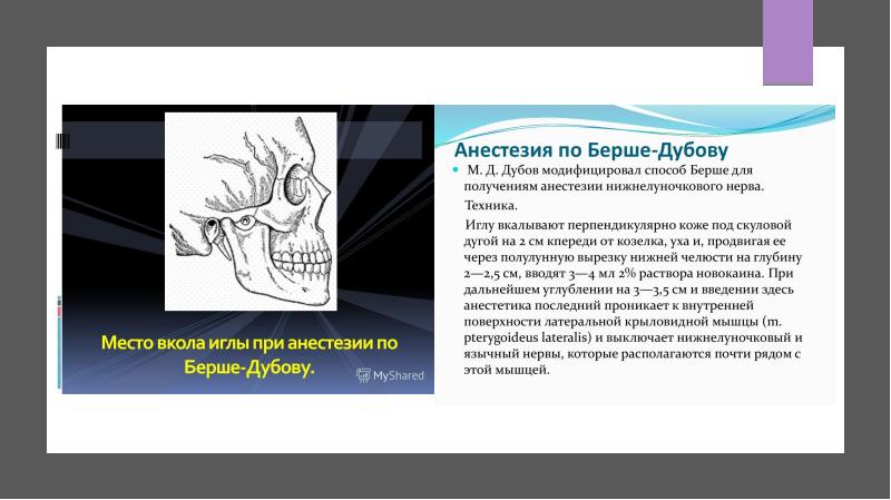 Анестезия по берше дубову презентация