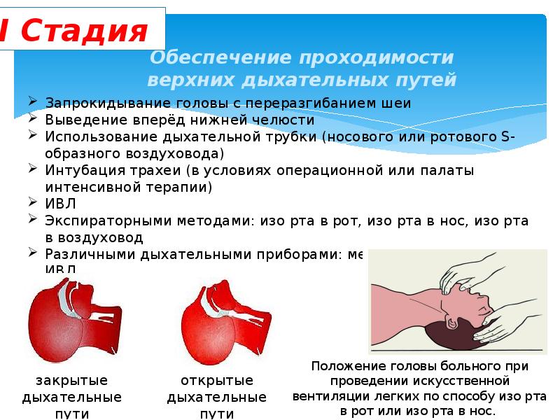 Как обеспечить восстановление. Методы обеспечения проходимости дыхательных путей. Способы обеспечения проходимости верхних дыхательных путей. Обеспечение проходимости дыхательных путей алгоритм. Обеспечение свободной проходимости дыхательных путей.