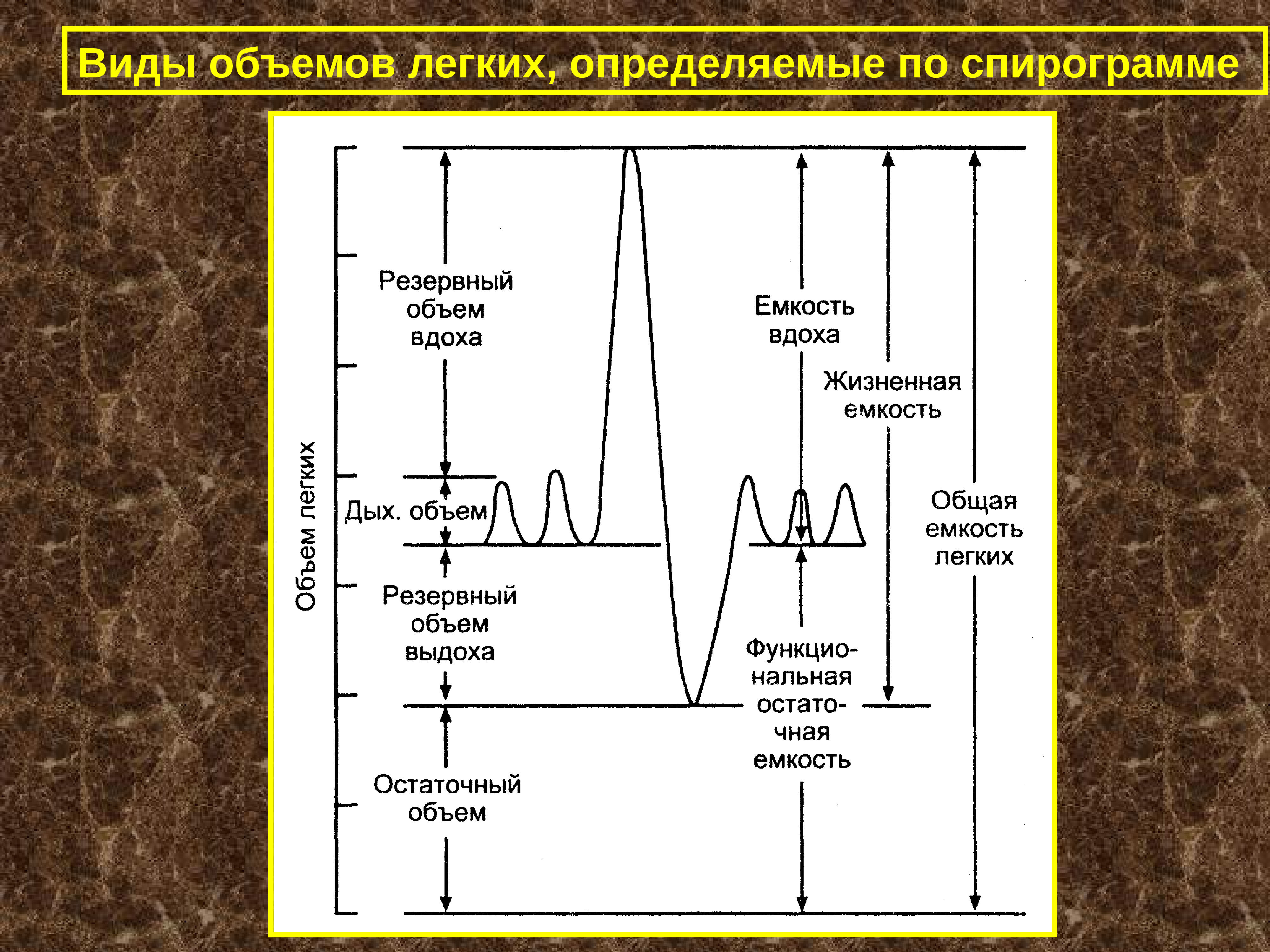 Жизненная и общая емкость легких. Спирограмма легочные объемы и емкости. Спирография физиология. Дыхательный объем на спирограмме. Основные легочные объемы на спирограмме.