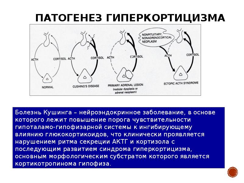 Патогенез гиперкортицизма схема