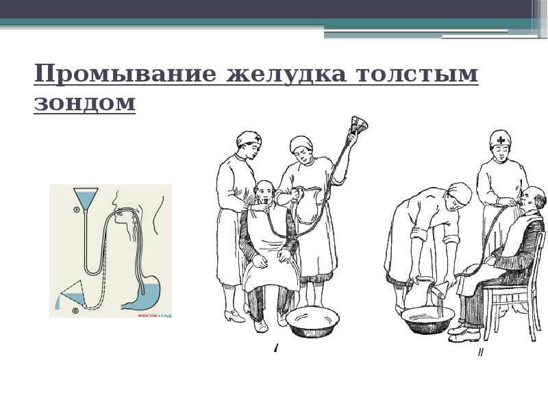 Презентация на тему промывание желудка