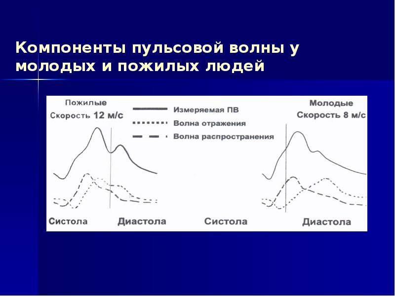 Сосудистая стенка вне пульсовой волны не пальпируется