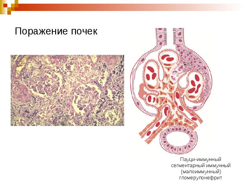 Клинический разбор пациента презентация