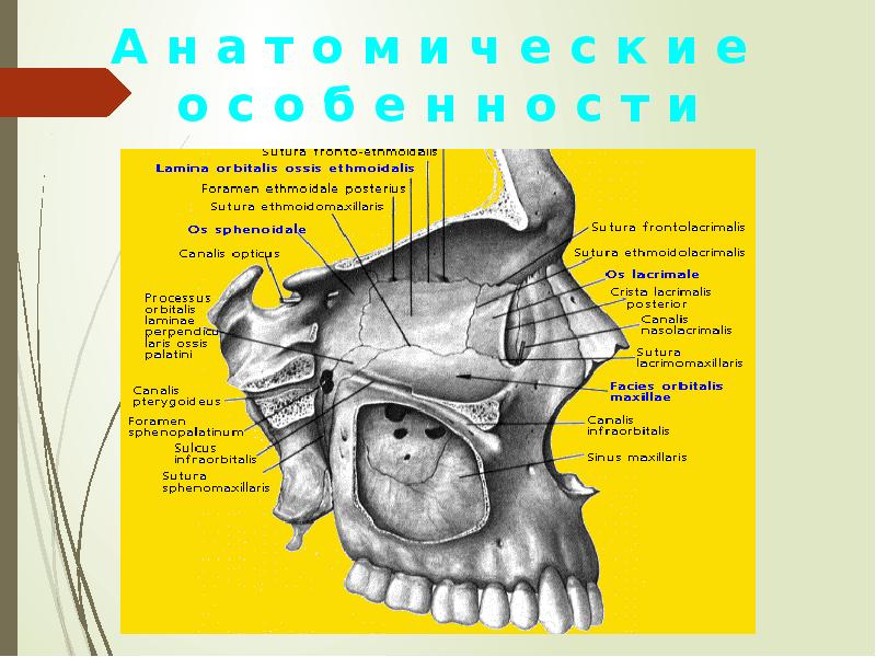 Одонтогенный гайморит презентация