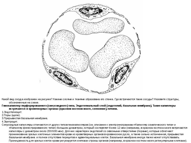 Назовите структуры обозначенной. Строение и типы гемокапилляров. Схема ультрамикроскопического строения трех типов гемокапилляров. Капилляр соматического типа схема. Проницаемость гемокапилляров схема.