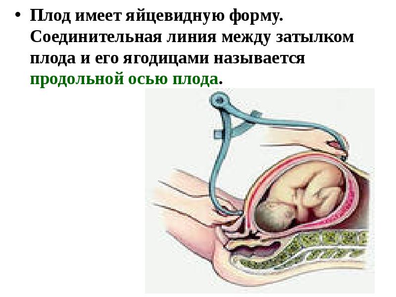 Обследование беременных женщин презентация