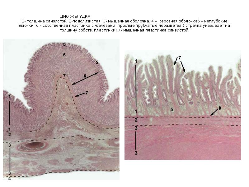 Пластинка слизистой. Триходермальная киста гистология. Дно желудка препарат гистология. Слизистая оболочка желудка гистология. Серозная оболочка гистология.