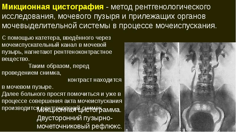 Патология мочевыделительной системы презентация