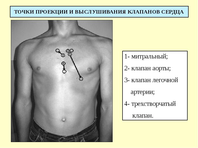 ТОЧКИ ПРОЕКЦИИ И ВЫСЛУШИВАНИЯ КЛАПАНОВ СЕРДЦА