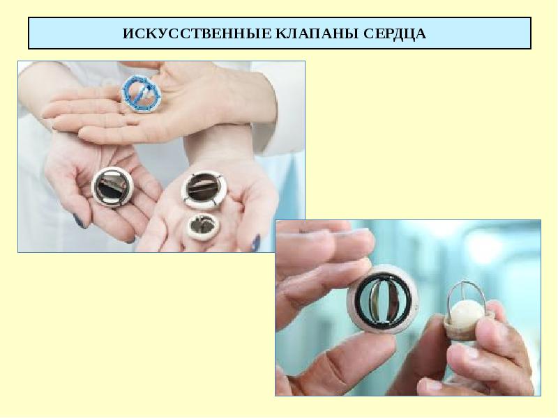 ИСКУССТВЕННЫЕ КЛАПАНЫ СЕРДЦА