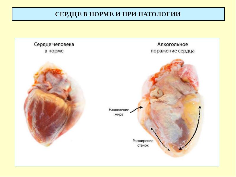 СЕРДЦЕ В НОРМЕ И ПРИ ПАТОЛОГИИ