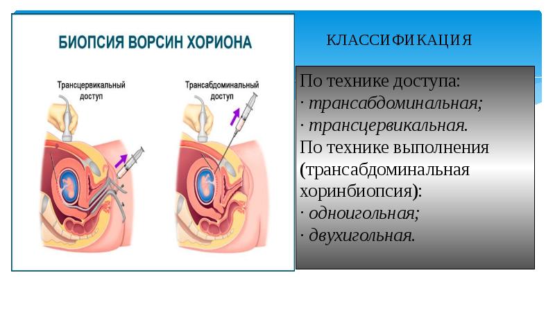 Методы пренатальной диагностики презентация