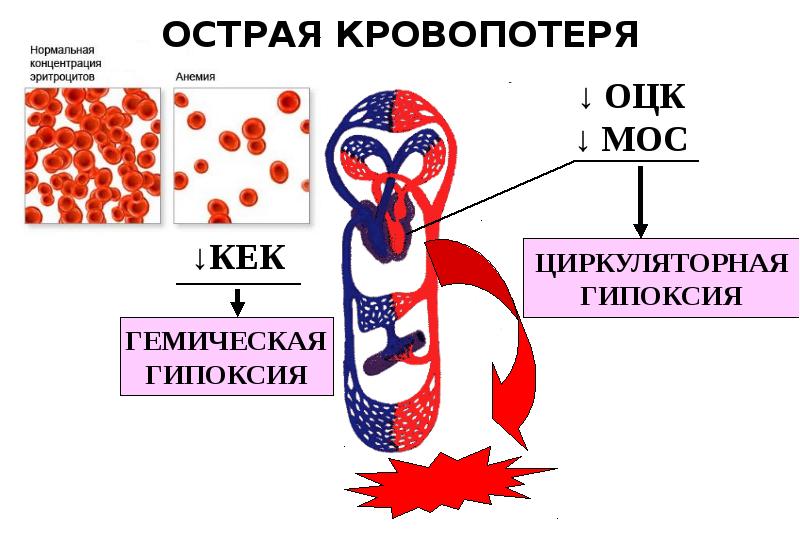 Гипоксия презентация картинки