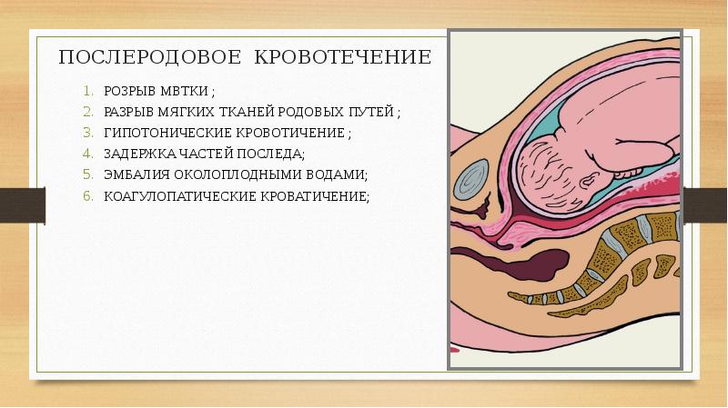 Послеродовое кровотечение презентация