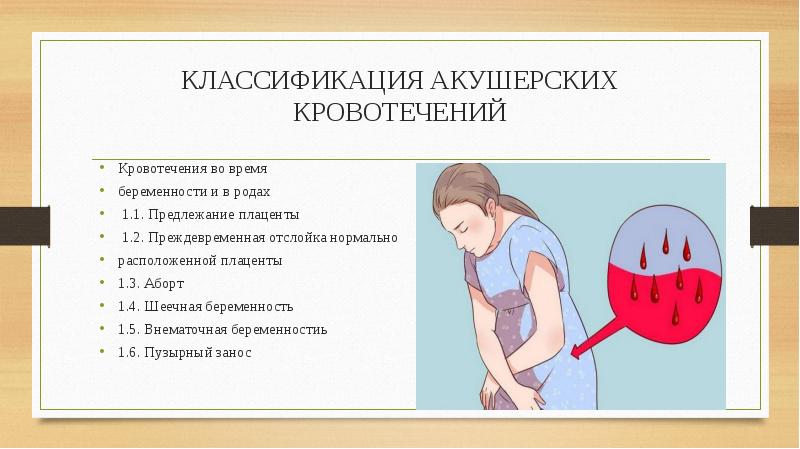 Акушерские кровотечения презентация