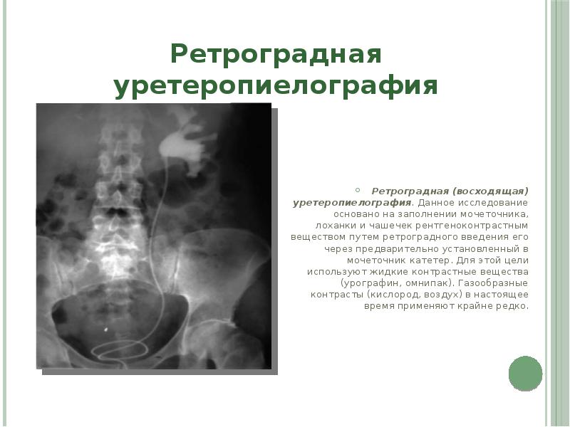 Инструментальные методы диагностики в урологии презентация