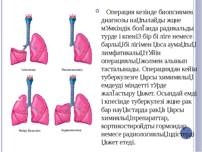 Туберкулез презентация powerpoint