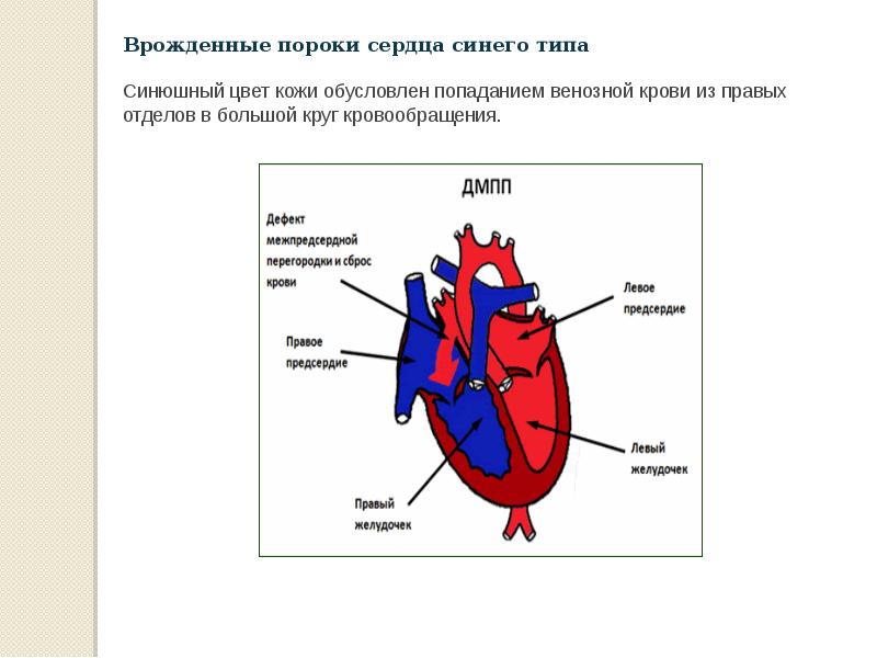 Врожденный венозный порок. Врожденные пороки сердца синего типа. Синие пороки сердца. Синие пороки сердца у детей. Пороки сердца синего типа.