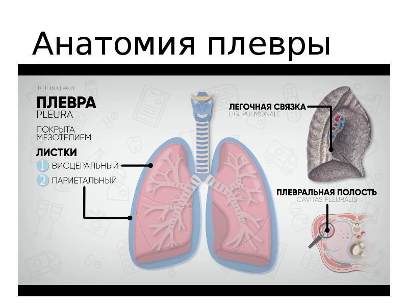 Пневмоторакс хирургия презентация