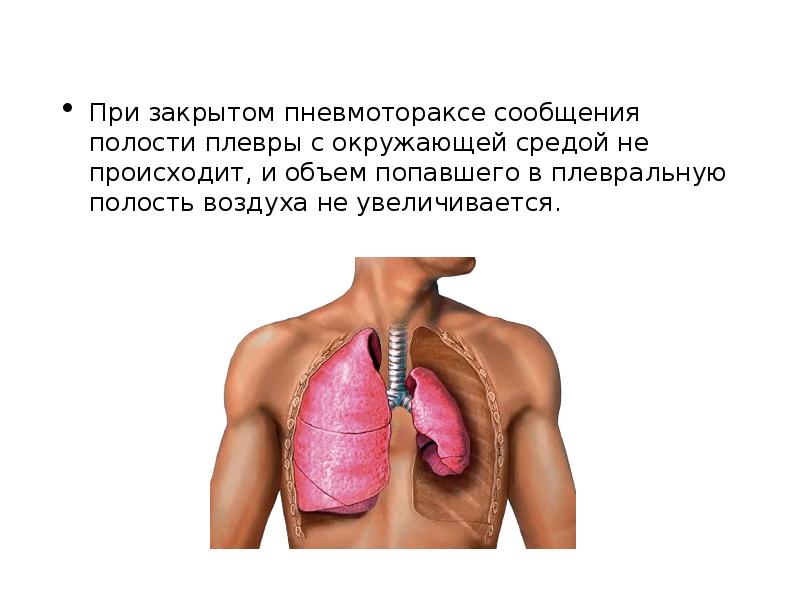 Презентация первая помощь при пневмотораксе