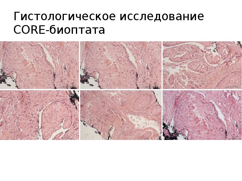 Гистология биоптата головы. Гистологическое исследование биоптата кожи. Гистология биоптата головы. Серебрение гистология. Цитология гистология разница.