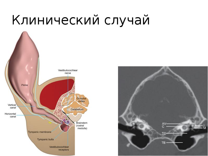 Клинический случай презентация