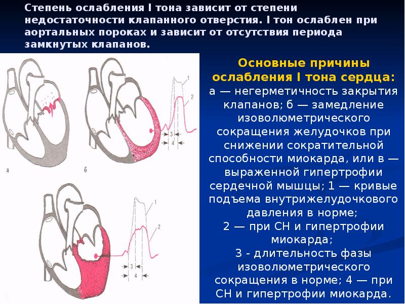 Аортальные пороки сердца презентация