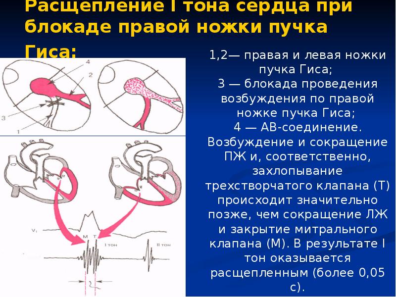 Правая ножка сердца