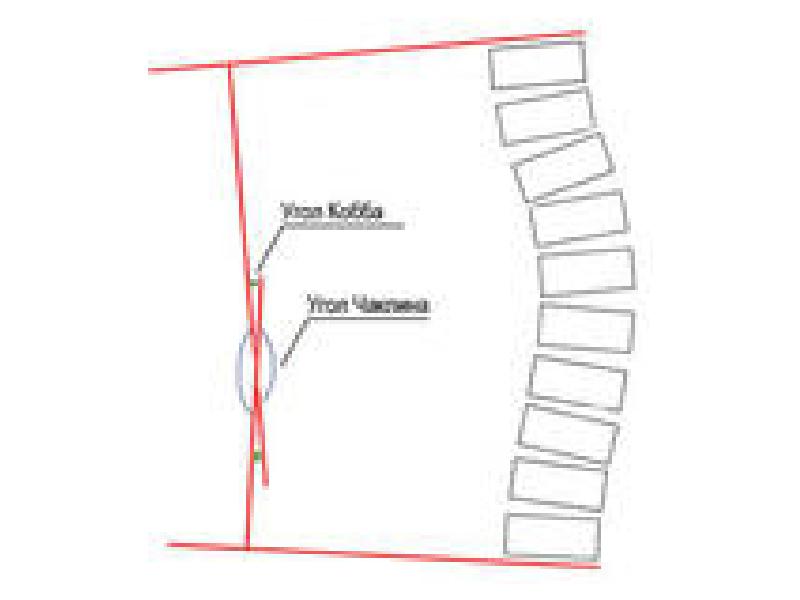 Степени кифоза по коббу. Измерение кифоза по коббу. Измерение угла деформации по коббу. Кифоз по коббу. Кифоз по коббу как чертить.