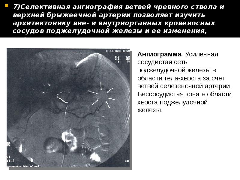 Лучевая диагностика печени и желчевыводящих путей презентация