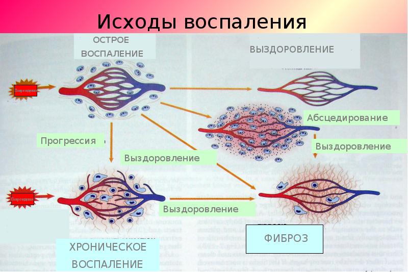 Презентация воспаление патологическая физиология