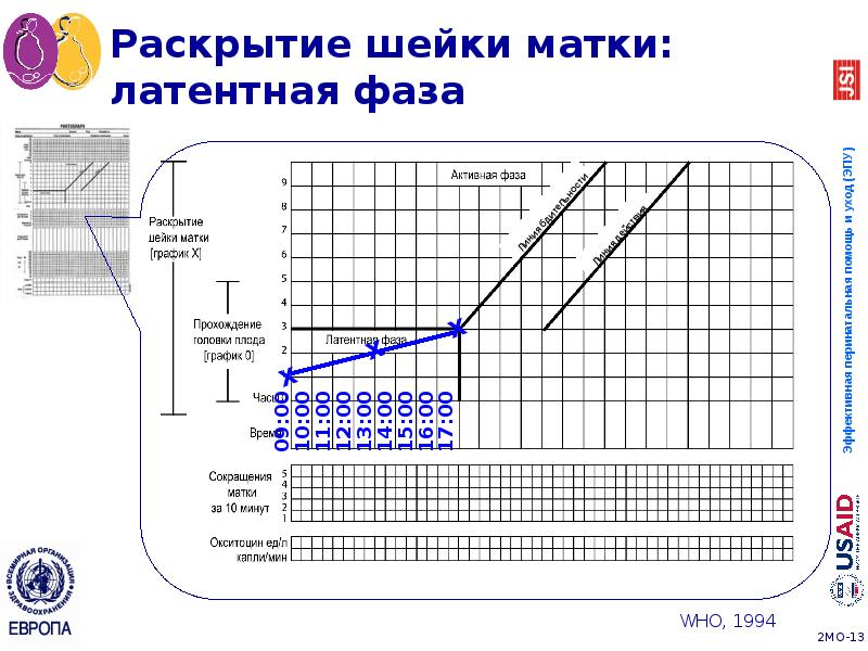 Партограмма в акушерстве как заполнять образец заполнения