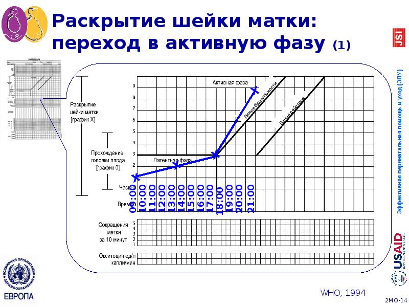 Раскрытие шейки матки: переход в активную фазу (1) Раскрытие шейки матки: переход в активную фазу (1)