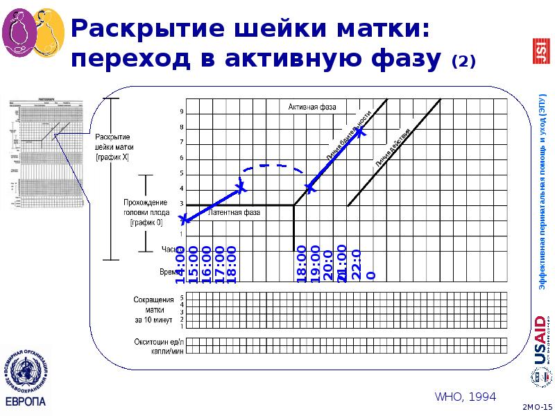 Раскрытие шейки матки: переход в активную фазу (2) Раскрытие шейки матки: переход в активную фазу (2)