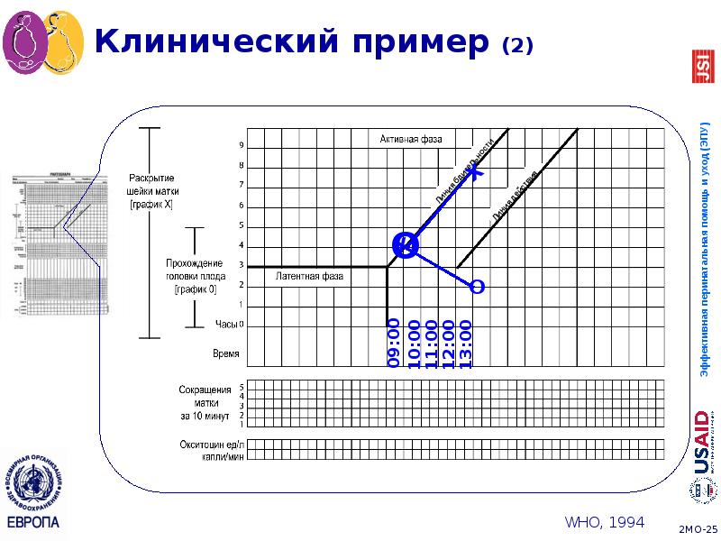 Клинический пример (2) Клинический пример (2)