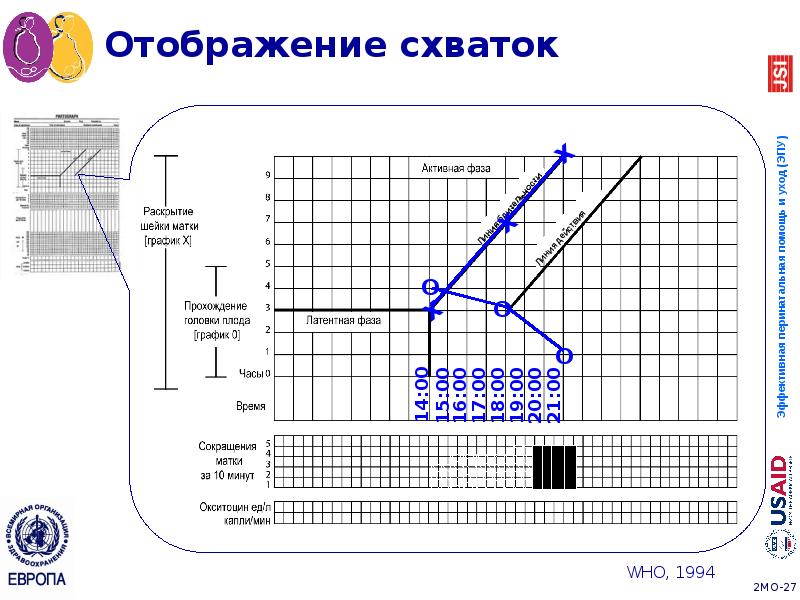 Отображение схваток Отображение схваток